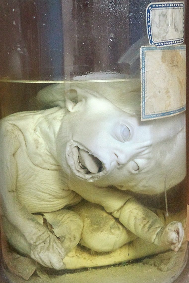 Antonio Cardarelli's Hospital anatomical preparations (8).jpg